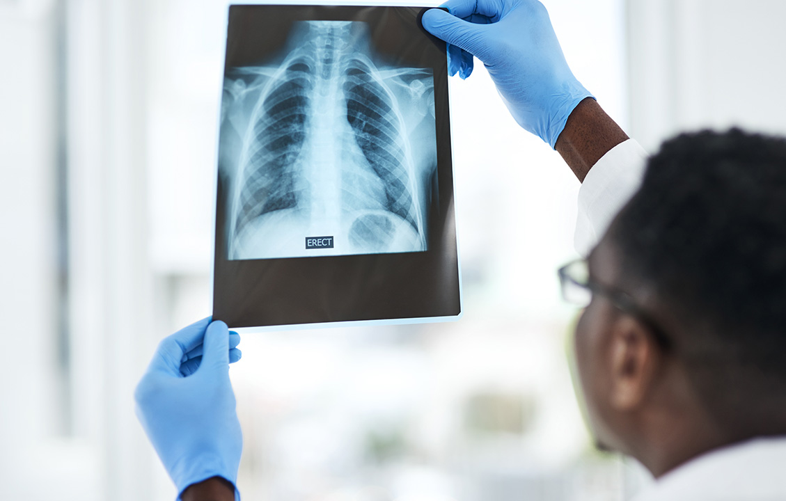 Zentrum f&uuml;r Zystische Fibrose, seltene Lungenerkrankungen und chronisch respiratorische Insuffizienz - Titelbild